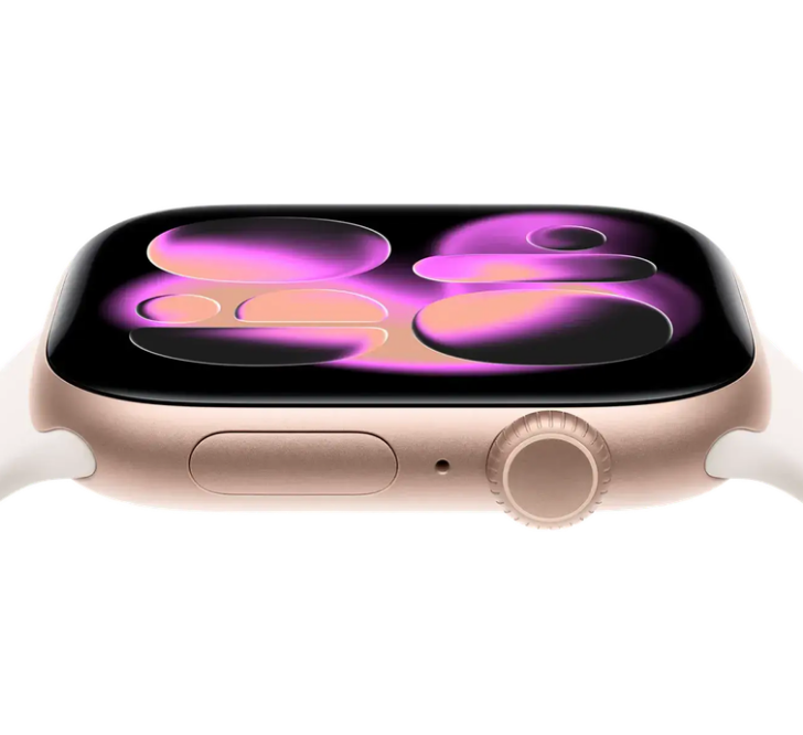 Apple Watch Series 11 - Image 3